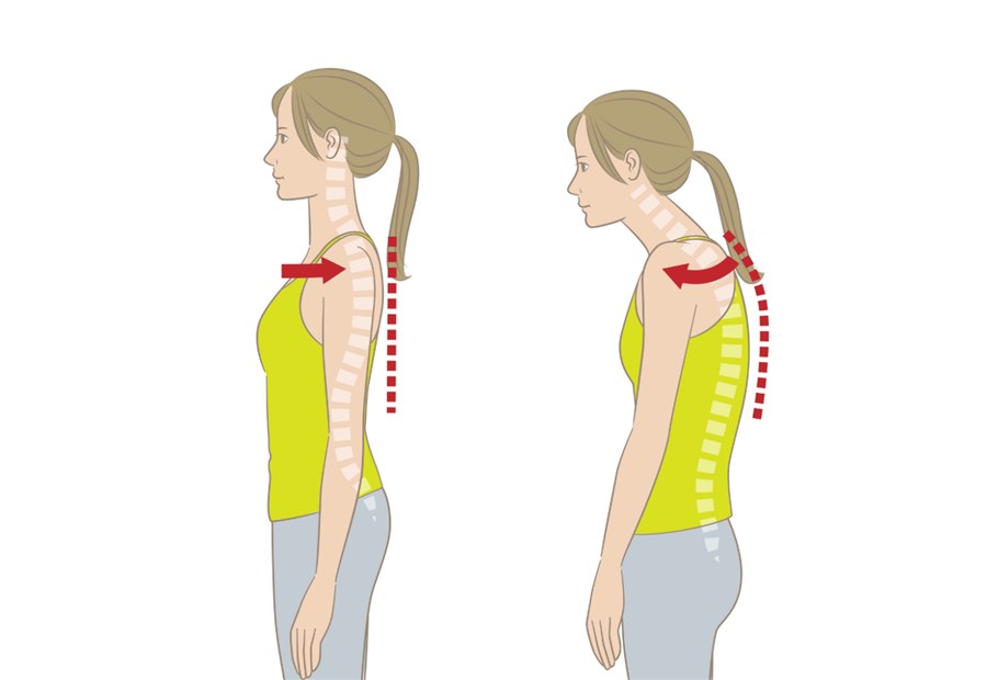 Postural Correction